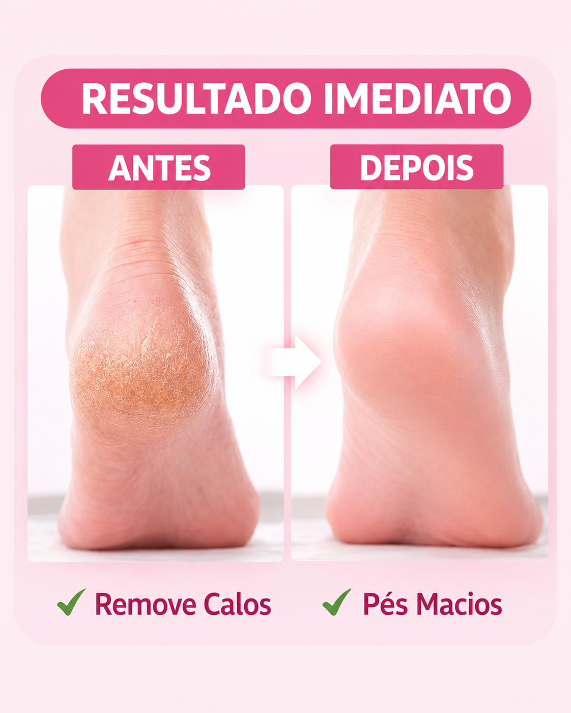 Antes e depois do uso da lixa de pé elétrica